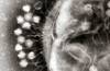 Phages attacking bacteria